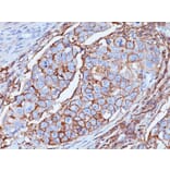 Immunohistochemistry - Anti-CD44 Antibody [DF1485] - BSA and Azide free (A253897) - Antibodies.com