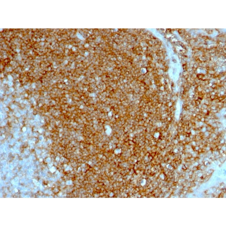 Immunohistochemistry - Anti-CD44 Antibody [HCAM/1097] - BSA and Azide free (A253897) - Antibodies.com