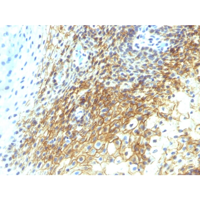 Immunohistochemistry - Anti-CD44v4 Antibody [CD44v4/1219] - BSA and Azide free (A253899) - Antibodies.com