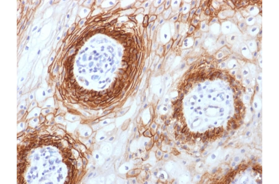 Immunohistochemistry - Anti-CD44v6 Antibody [CD44v6/1246] - BSA and Azide free (A253900) - Antibodies.com