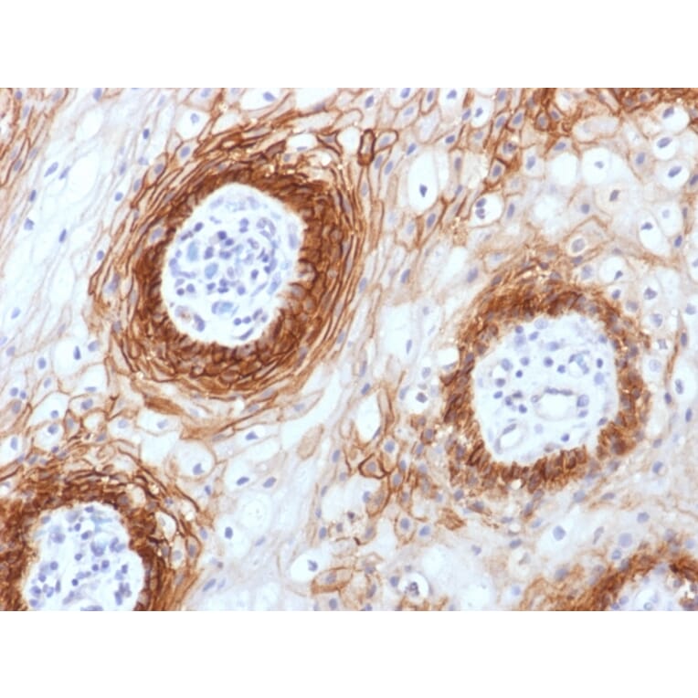 Immunohistochemistry - Anti-CD44v6 Antibody [CD44v6/1246] - BSA and Azide free (A253900) - Antibodies.com