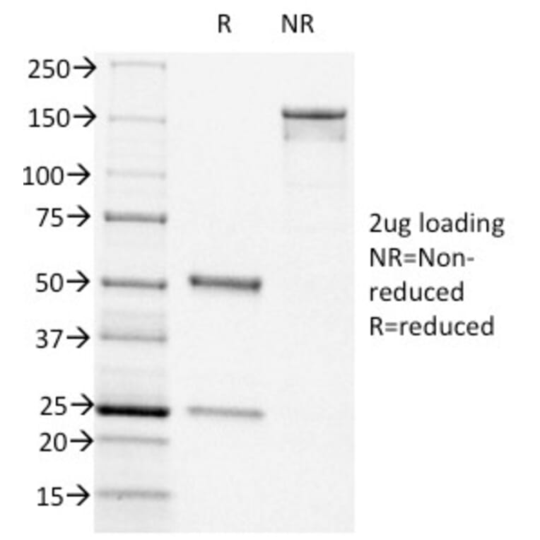 SDS-PAGE - Anti-CD44v6 Antibody [CD44v6/1246] - BSA and Azide free (A253900) - Antibodies.com
