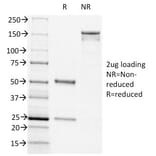 SDS-PAGE - Anti-CD44v6 Antibody [CD44v6/1246] - BSA and Azide free (A253900) - Antibodies.com