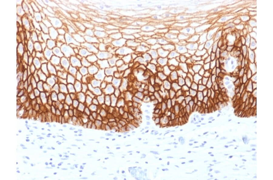 Immunohistochemistry - Anti-CD44v9 Antibody [CD44v9/1459] - BSA and Azide free (A253900) - Antibodies.com