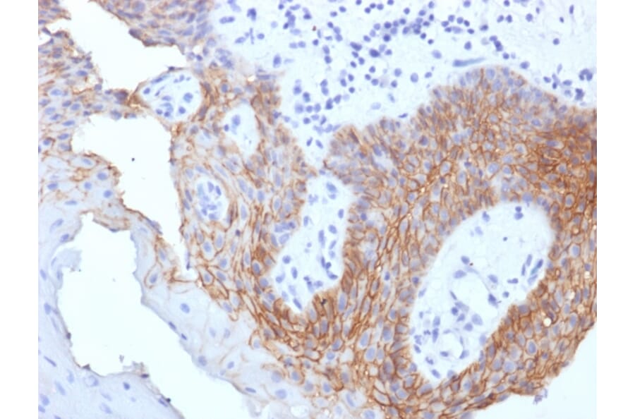 Immunohistochemistry - Anti-CD44v9 Antibody [CD44v9/1459] - BSA and Azide free (A253901) - Antibodies.com