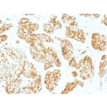 Immunohistochemistry - Anti-CD44v9 Antibody [CD44v9/1459] - BSA and Azide free (A253901) - Antibodies.com