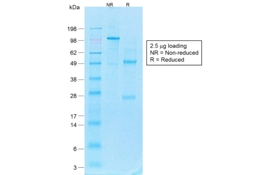 SDS-PAGE - Anti-CD44v4 Antibody [CD44v4/1700R] - BSA and Azide free (A253902) - Antibodies.com