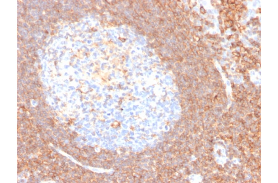 Immunohistochemistry - Anti-CD44 Antibody [HCAM/4110R] - BSA and Azide free (A253904) - Antibodies.com