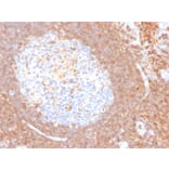 Immunohistochemistry - Anti-CD44 Antibody [HCAM/4110R] - BSA and Azide free (A253904) - Antibodies.com