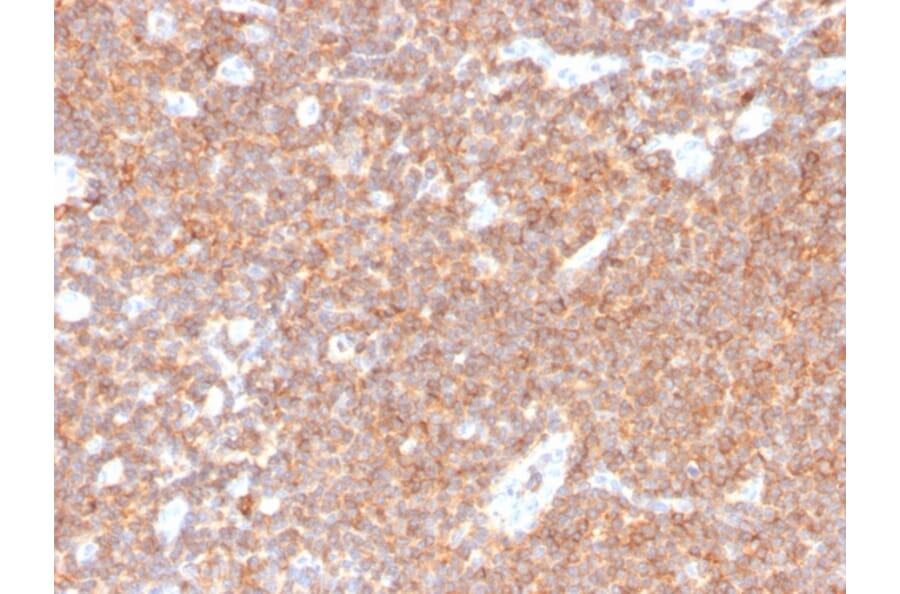 Immunohistochemistry - Anti-CD44 Antibody [HCAM/4110R] - BSA and Azide free (A253904) - Antibodies.com