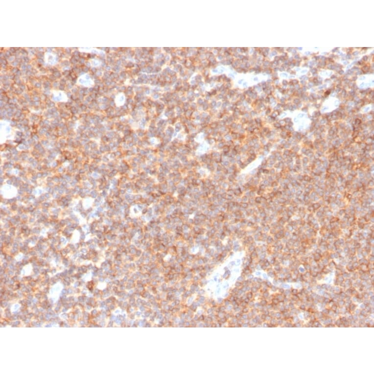 Immunohistochemistry - Anti-CD44 Antibody [HCAM/4110R] - BSA and Azide free (A253904) - Antibodies.com