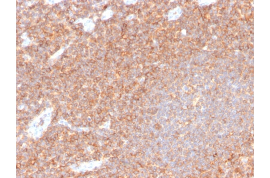 Immunohistochemistry - Anti-CD44 Antibody [HCAM/4110R] - BSA and Azide free (A253903) - Antibodies.com