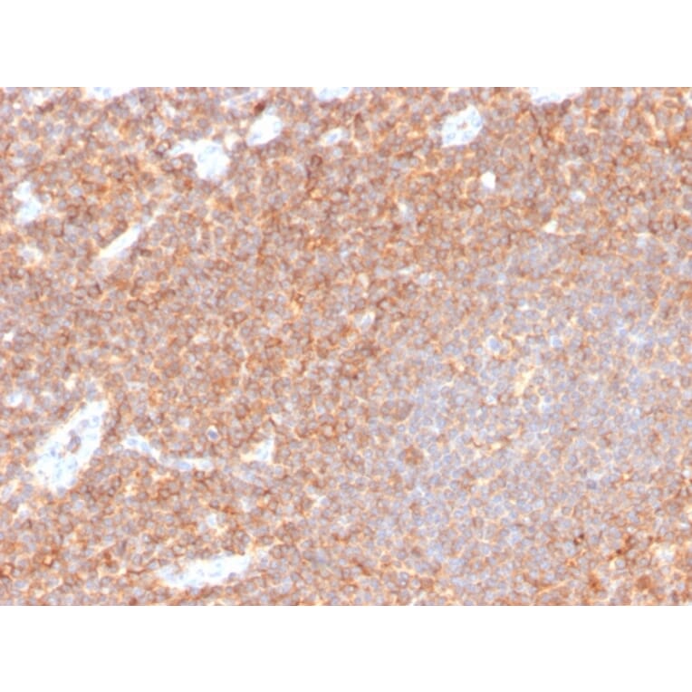 Immunohistochemistry - Anti-CD44 Antibody [HCAM/4110R] - BSA and Azide free (A253903) - Antibodies.com
