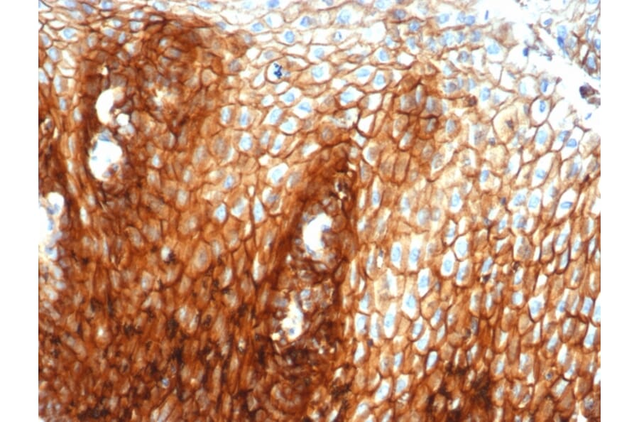 Immunohistochemistry - Anti-CD44 Antibody [HCAM/6459R] - BSA and Azide free (A253905) - Antibodies.com