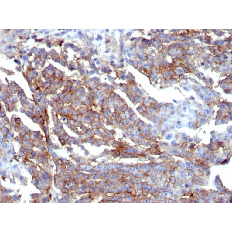 Immunohistochemistry - Anti-CD44 Antibody [HCAM/6459R] - BSA and Azide free (A253904) - Antibodies.com