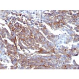 Immunohistochemistry - Anti-CD44 Antibody [HCAM/6459R] - BSA and Azide free (A253904) - Antibodies.com