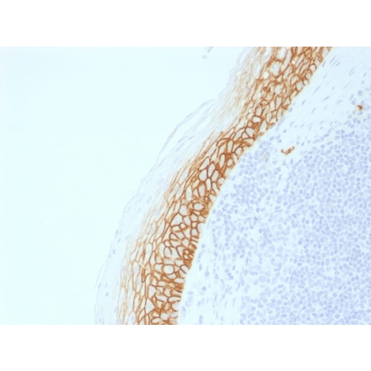 Immunohistochemistry - Anti-CD44v9 Antibody [CD44v9/2344R] - BSA and Azide free (A253905) - Antibodies.com
