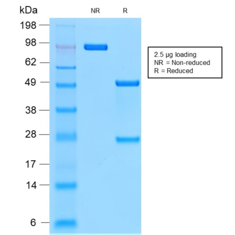 SDS-PAGE - Anti-CD44v9 Antibody [CD44v9/2344R] - BSA and Azide free (A253906) - Antibodies.com