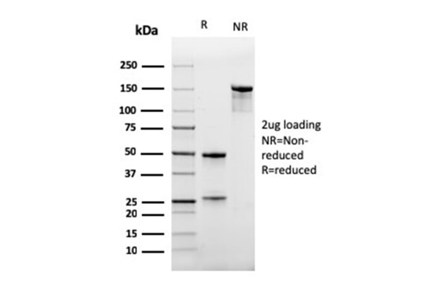 SDS-PAGE - Anti-CD47 Antibody [IAP/964] - BSA and Azide free (A253909) - Antibodies.com