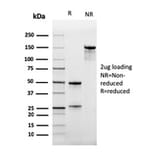 SDS-PAGE - Anti-CD47 Antibody [IAP/964] - BSA and Azide free (A253909) - Antibodies.com