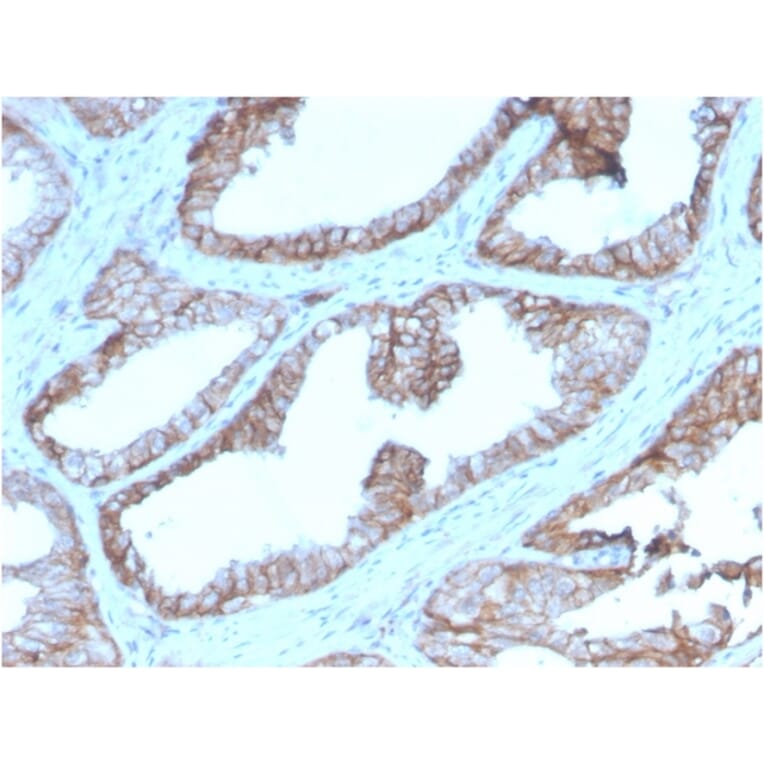 Immunohistochemistry - Anti-CD47 Antibody [CD47/2937] - BSA and Azide free (A253911) - Antibodies.com