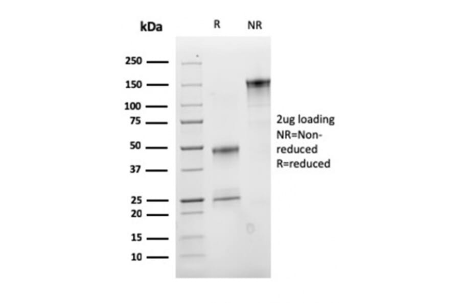 SDS-PAGE - Anti-CD47 Antibody [CD47/2937] - BSA and Azide free (A253911) - Antibodies.com