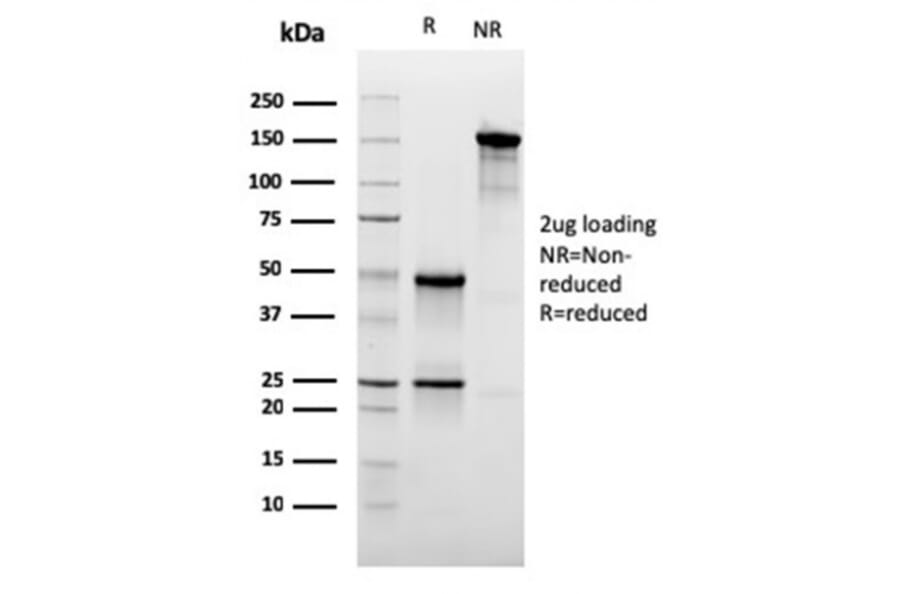 SDS-PAGE - Anti-CD47 Antibody [CD47/3019] - BSA and Azide free (A253912) - Antibodies.com