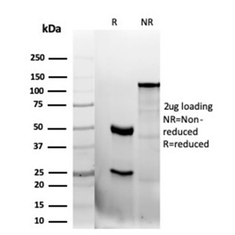 SDS-PAGE - Anti-CD47 Antibody [CD47/6362R] - BSA and Azide free (A253913) - Antibodies.com