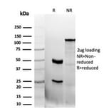 SDS-PAGE - Anti-CD47 Antibody [CD47/6362R] - BSA and Azide free (A253913) - Antibodies.com