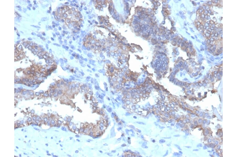 Immunohistochemistry - Anti-CD47 Antibody [CD47/6362R] - BSA and Azide free (A253912) - Antibodies.com