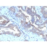 Immunohistochemistry - Anti-CD47 Antibody [CD47/6362R] - BSA and Azide free (A253912) - Antibodies.com