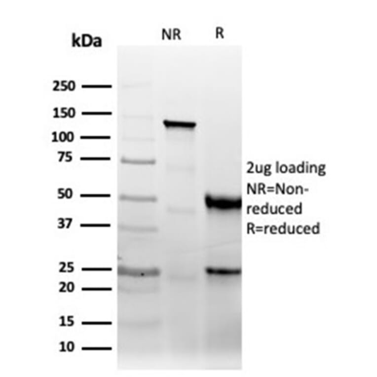 SDS-PAGE - Anti-CD47 Antibody [CD47/6364R] - BSA and Azide free (A253914) - Antibodies.com