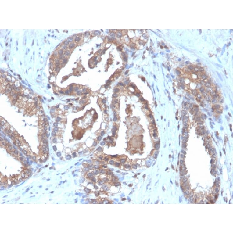 Immunohistochemistry - Anti-CD47 Antibody [CD47/6364R] - BSA and Azide free (A253913) - Antibodies.com