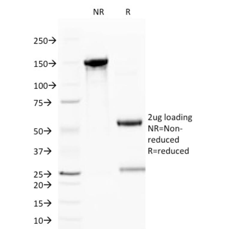 SDS-PAGE - Anti-CD59 Antibody [BRA-10G] - BSA and Azide free (A253918) - Antibodies.com