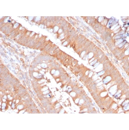 Immunohistochemistry - Anti-CD59 Antibody [MACIF/2867R] - BSA and Azide free (A253921) - Antibodies.com