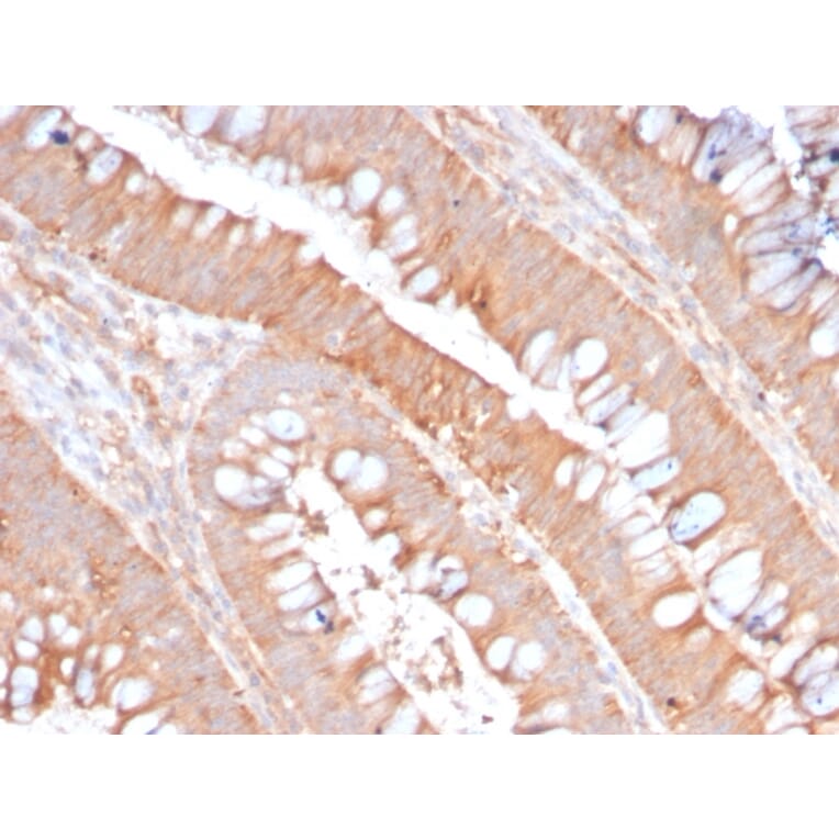 Immunohistochemistry - Anti-CD59 Antibody [MACIF/2867R] - BSA and Azide free (A253921) - Antibodies.com
