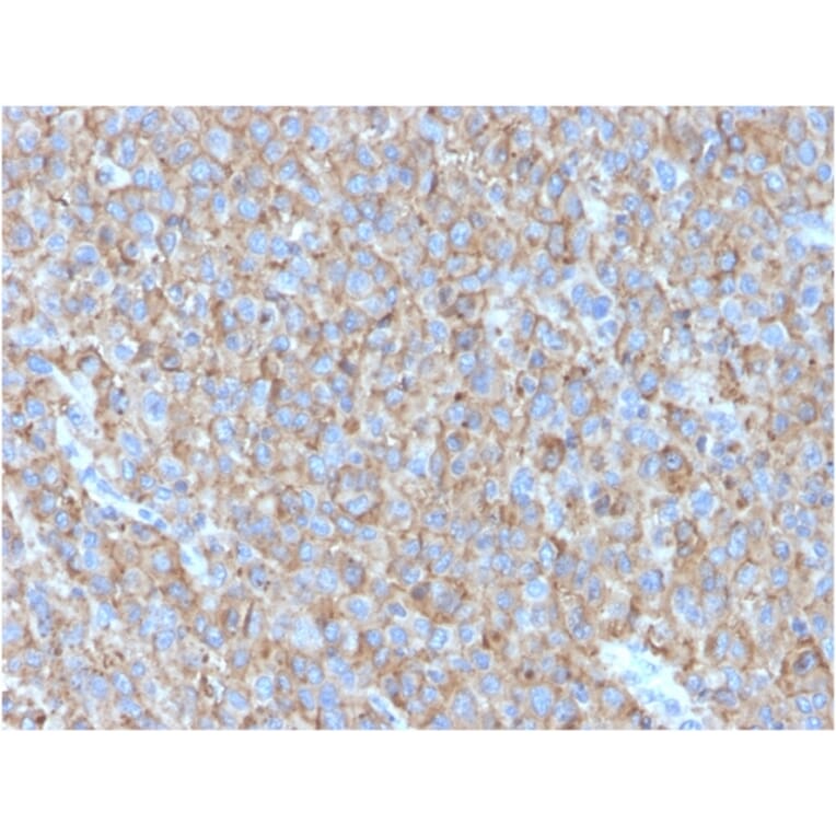 Immunohistochemistry - Anti-CD63 Antibody [LAMP3/2790] - BSA and Azide free (A253923) - Antibodies.com