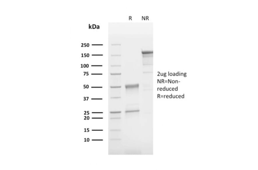 SDS-PAGE - Anti-CD63 Antibody [LAMP3/2790] - BSA and Azide free (A253923) - Antibodies.com