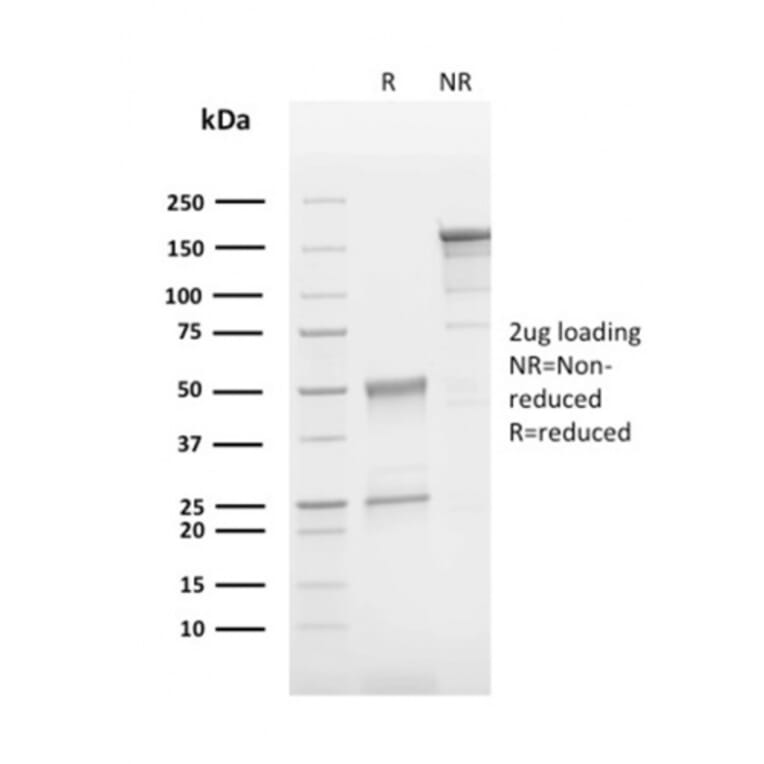 SDS-PAGE - Anti-CD63 Antibody [LAMP3/2790] - BSA and Azide free (A253923) - Antibodies.com