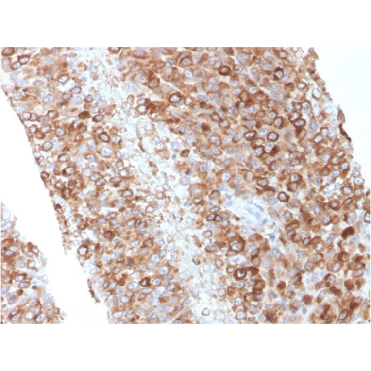 Immunohistochemistry - Anti-CD63 Antibody [LAMP3/2881] - BSA and Azide free (A253924) - Antibodies.com