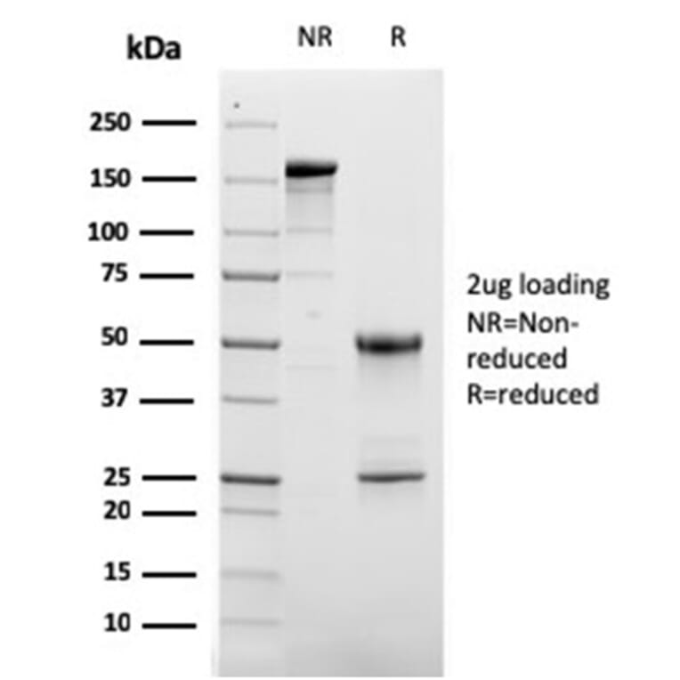 SDS-PAGE - Anti-CD63 Antibody [LAMP3/2881] - BSA and Azide free (A253924) - Antibodies.com