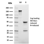 SDS-PAGE - Anti-CD63 Antibody [LAMP3/2881] - BSA and Azide free (A253924) - Antibodies.com