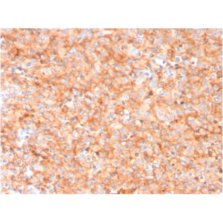 Immunohistochemistry - Anti-CD63 Antibody [LAMP3/3315] - BSA and Azide free (A253925) - Antibodies.com