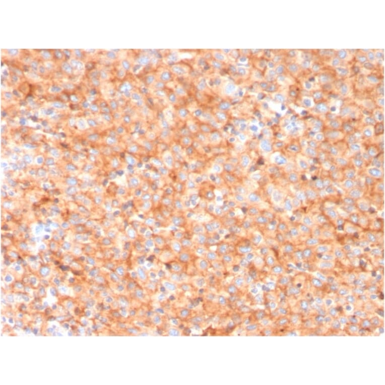 Immunohistochemistry - Anti-CD63 Antibody [LAMP3/3315] - BSA and Azide free (A253925) - Antibodies.com