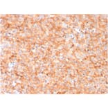 Immunohistochemistry - Anti-CD63 Antibody [LAMP3/3315] - BSA and Azide free (A253925) - Antibodies.com