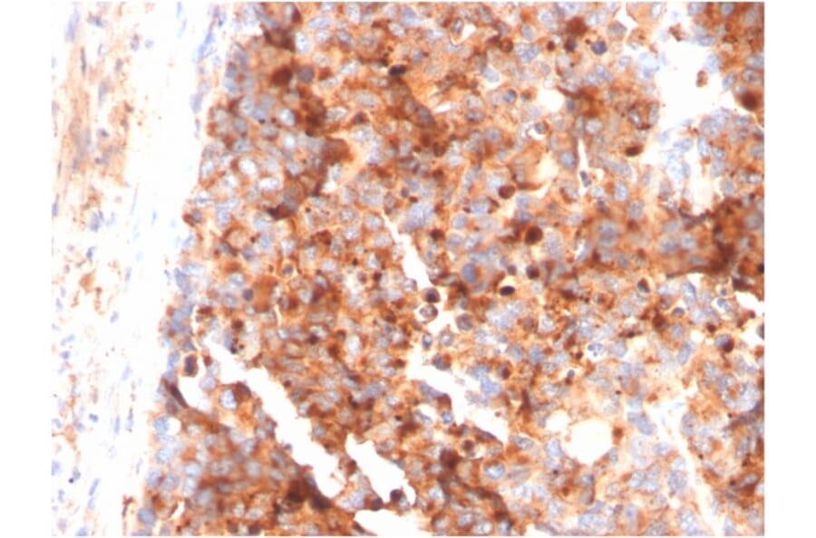 Immunohistochemistry - Anti-CD63 Antibody [LAMP3/3315] - BSA and Azide free (A253925) - Antibodies.com