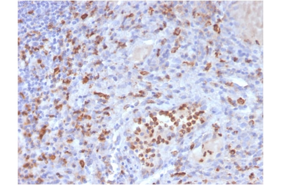 Immunohistochemistry - Anti-CD63 Antibody [LAMP3/3315] - BSA and Azide free (A253925) - Antibodies.com