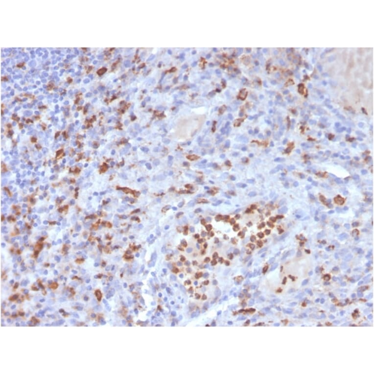 Immunohistochemistry - Anti-CD63 Antibody [LAMP3/3315] - BSA and Azide free (A253925) - Antibodies.com
