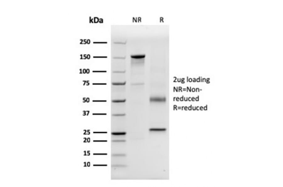 SDS-PAGE - Anti-CD63 Antibody [LAMP3/3315] - BSA and Azide free (A253925) - Antibodies.com