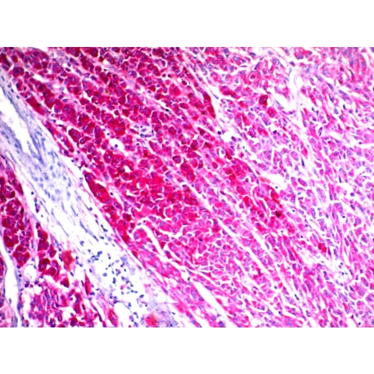 Immunohistochemistry - Anti-CD63 Antibody [NKI/C3] - BSA and Azide free (A253926) - Antibodies.com